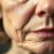 Objawy skórne menopauzy – jak je rozpoznać i pielęgnować?